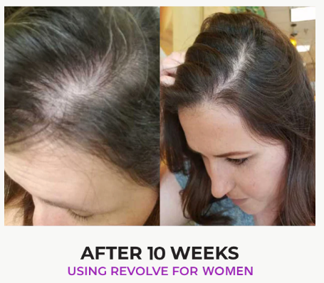 Revolve Thickening Shampoo Duo